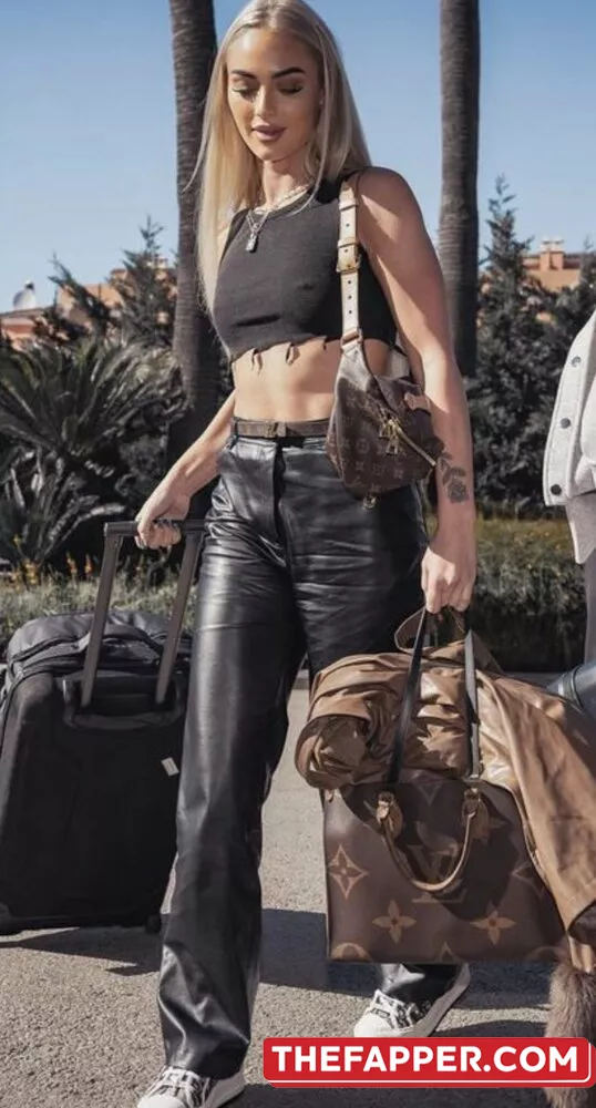 Alisha Lehmann  Onlyfans Leaked Nude Image #QMYDIfx3Iy