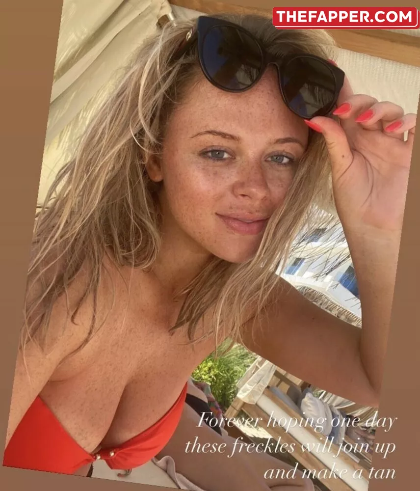 Emily Atack  Onlyfans Leaked Nude Image #5w9jC4iCTL