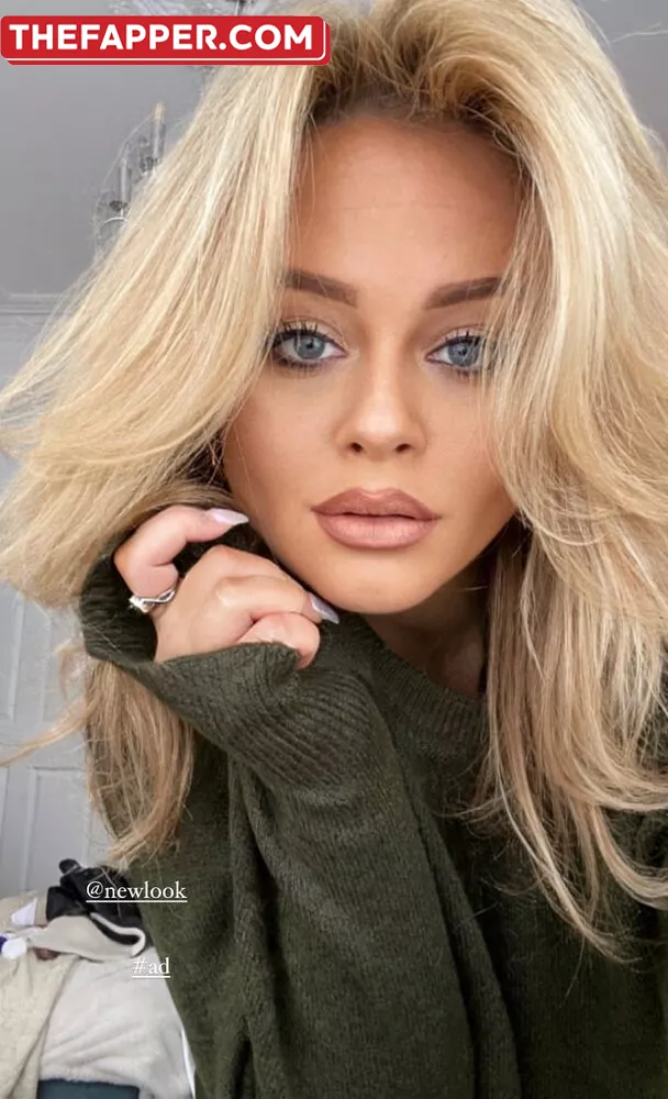 Emily Atack  Onlyfans Leaked Nude Image #8Gufl698cU