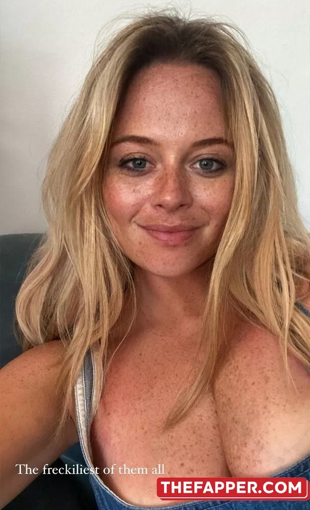 Emily Atack  Onlyfans Leaked Nude Image #APmEwHjV7C