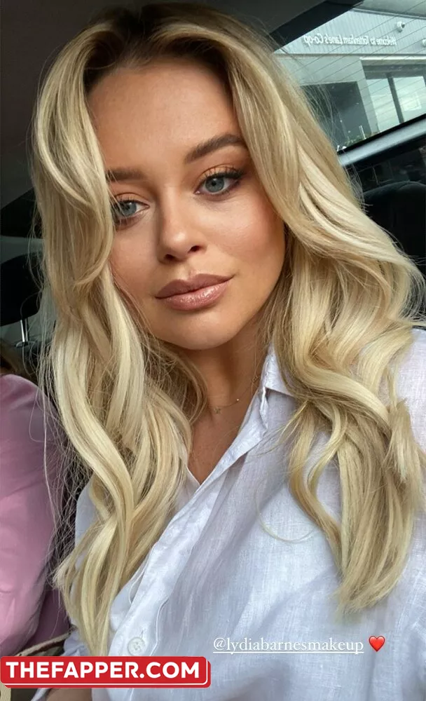 Emily Atack  Onlyfans Leaked Nude Image #CDrikztPGk