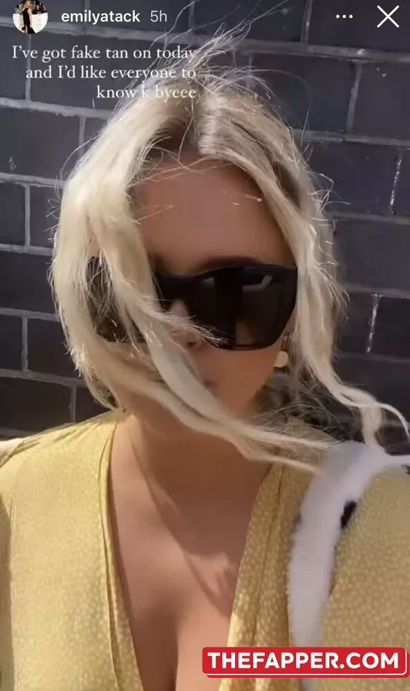 Emily Atack  Onlyfans Leaked Nude Image #CnXKVJYSCa