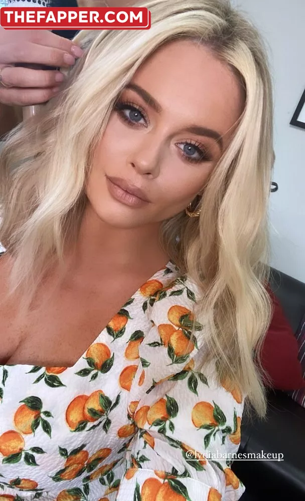 Emily Atack  Onlyfans Leaked Nude Image #DZj8auld70