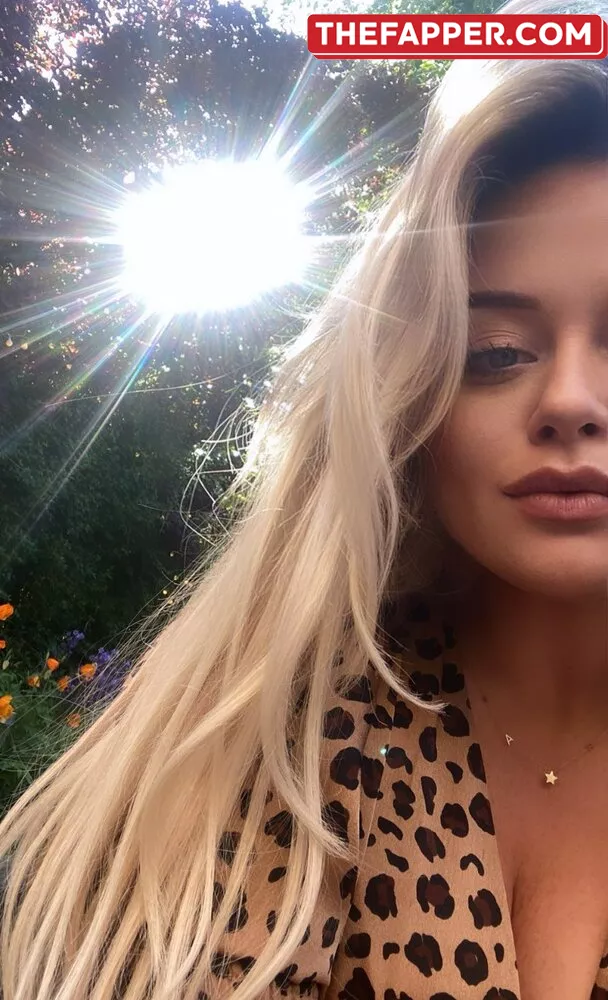 Emily Atack  Onlyfans Leaked Nude Image #ISqINNBQUD