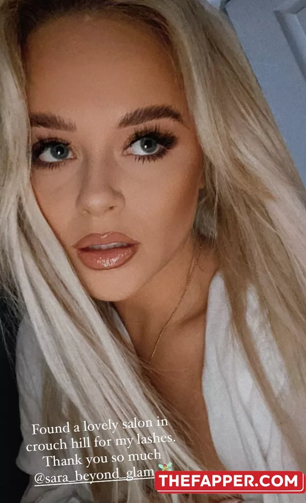 Emily Atack  Onlyfans Leaked Nude Image #LQbrth0RQp