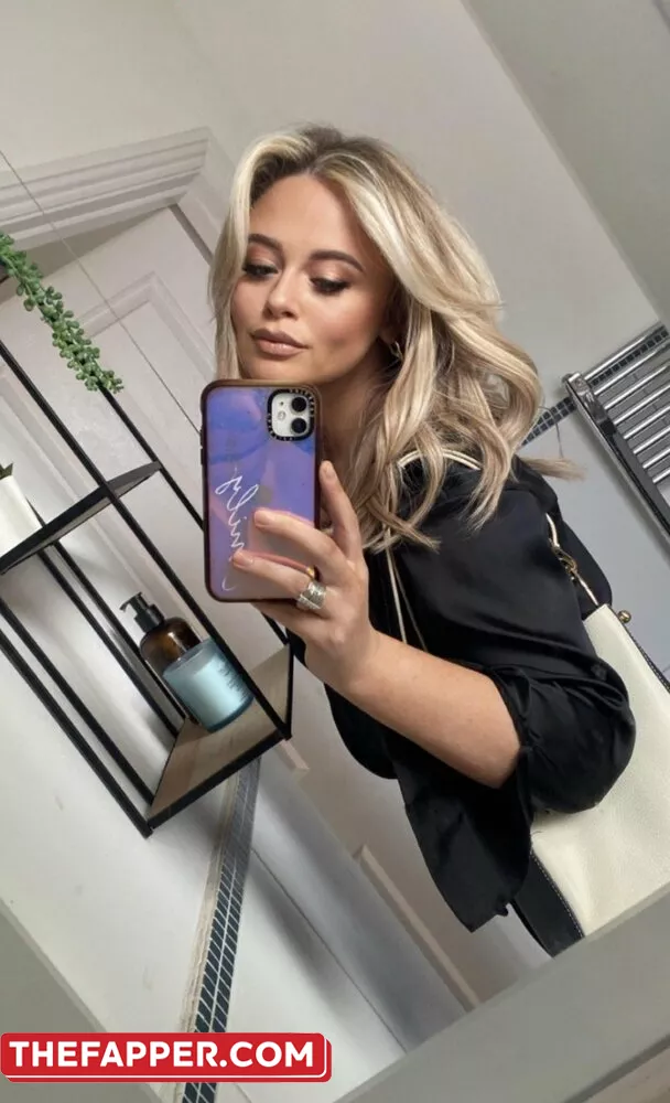 Emily Atack  Onlyfans Leaked Nude Image #RglPznstMb