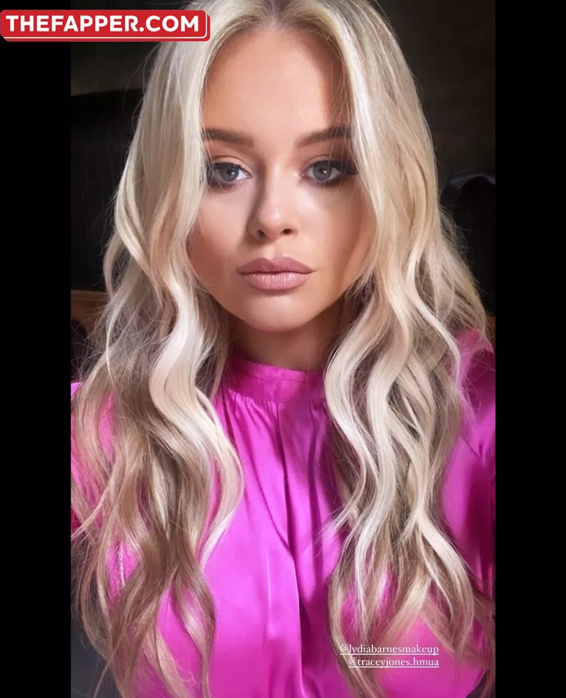 Emily Atack  Onlyfans Leaked Nude Image #TMzlYslZMA