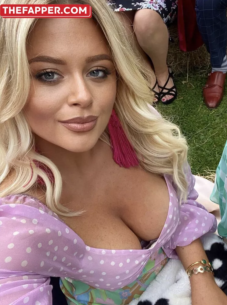 Emily Atack  Onlyfans Leaked Nude Image #WU6nCMhQ4O