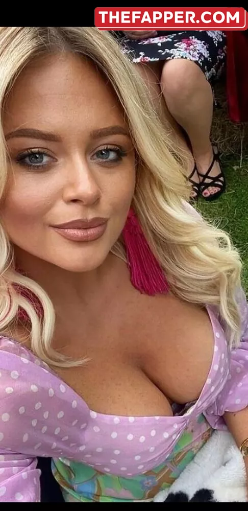 Emily Atack  Onlyfans Leaked Nude Image #erlG58z0z5