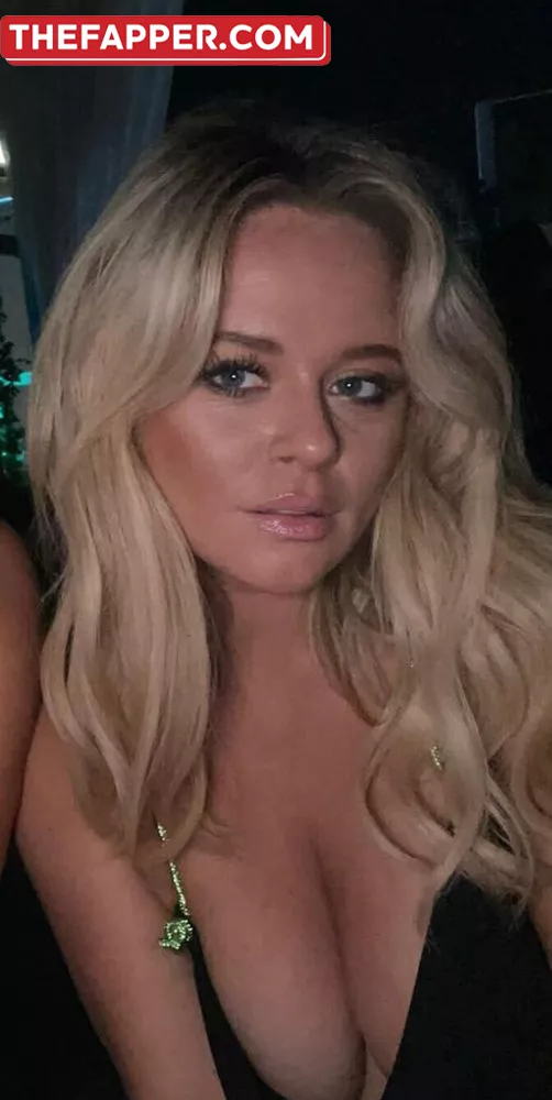 Emily Atack  Onlyfans Leaked Nude Image #k9PtdP76vw