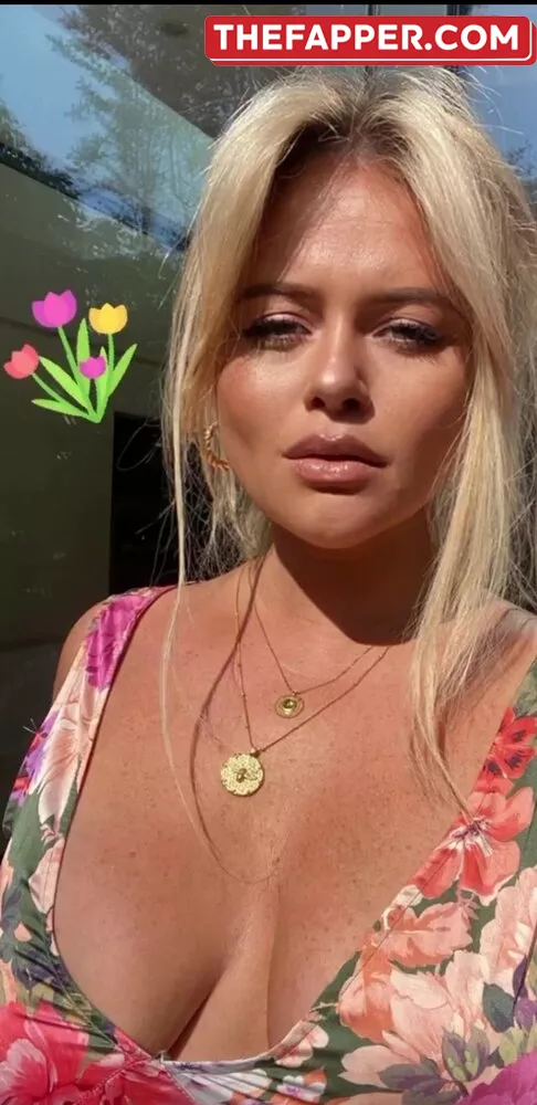 Emily Atack  Onlyfans Leaked Nude Image #p8Kv38mMyt