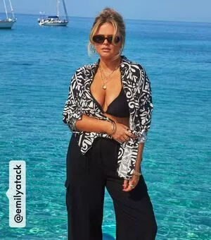 Emily Atack Onlyfans Leaked Nude Image #pQnXMFOBBq