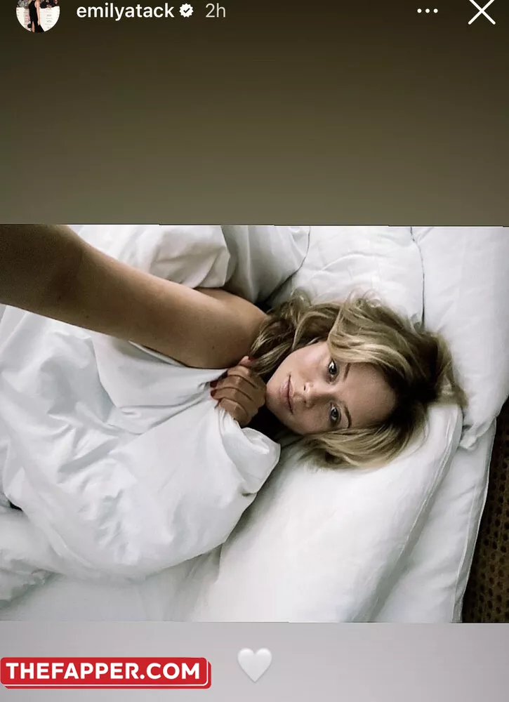 Emily Atack  Onlyfans Leaked Nude Image #tFzJxJezPy