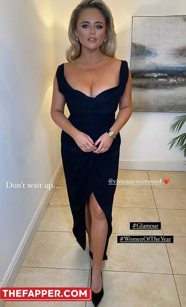 Emily Atack  Onlyfans Leaked Nude Image #vxFokSOOyi