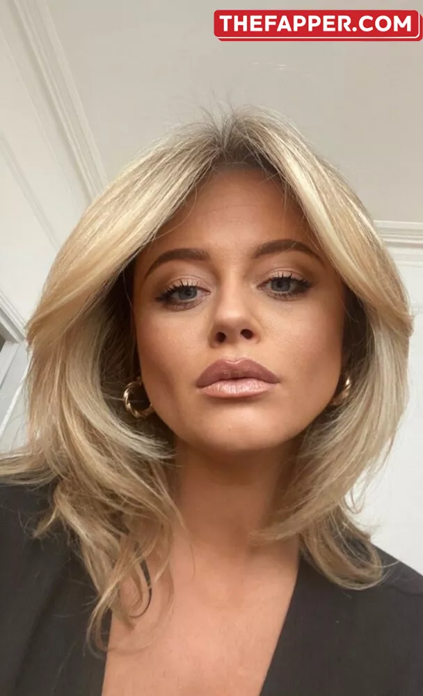 Emily Atack  Onlyfans Leaked Nude Image #z1voYER6le