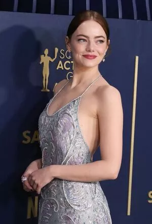 Emma Stone Onlyfans Leaked Nude Image #Q7GbSHYRr8
