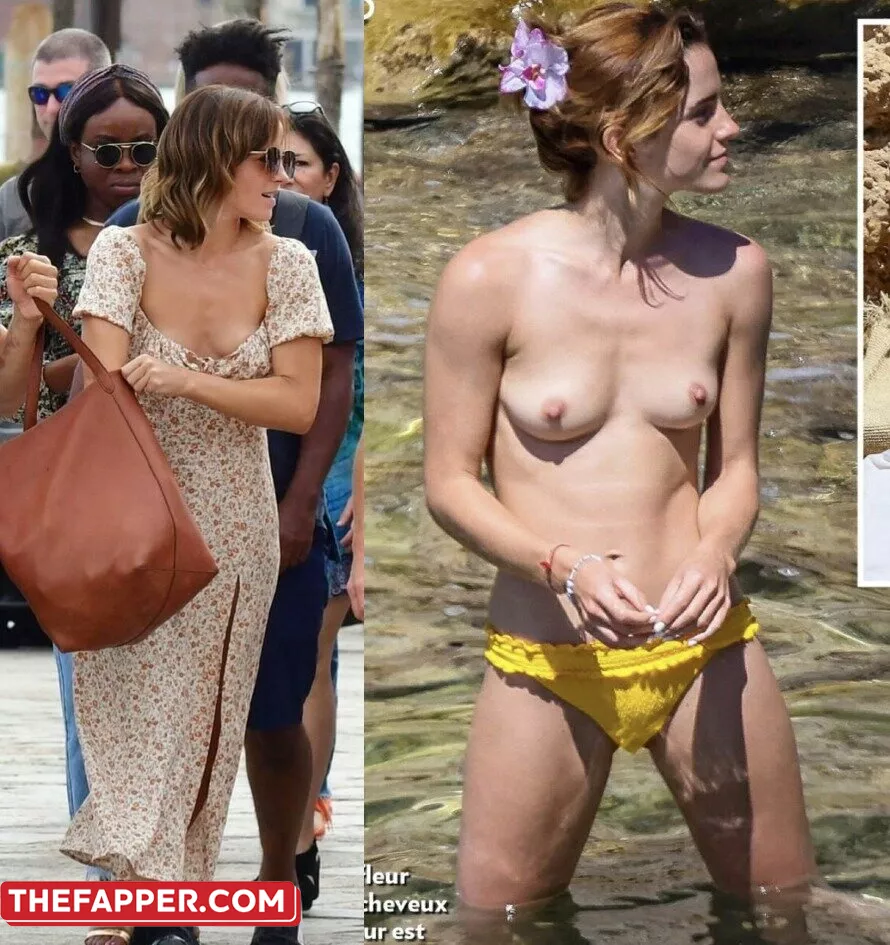 Emma Watson  Onlyfans Leaked Nude Image #sfZv06aznz