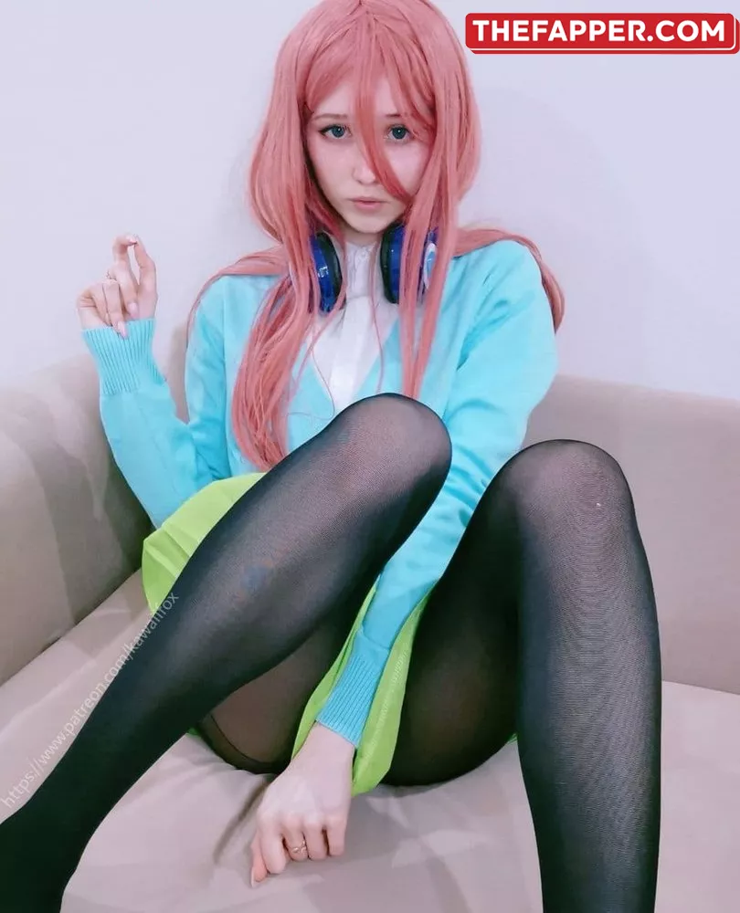 Kawaii Fox Tyan  Onlyfans Leaked Nude Image #bHDofYaK7I