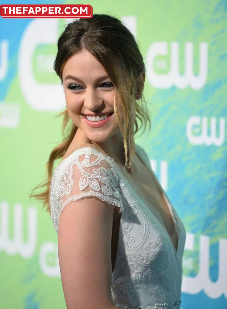 Melissa Benoist  Onlyfans Leaked Nude Image #USVSdbg7sF