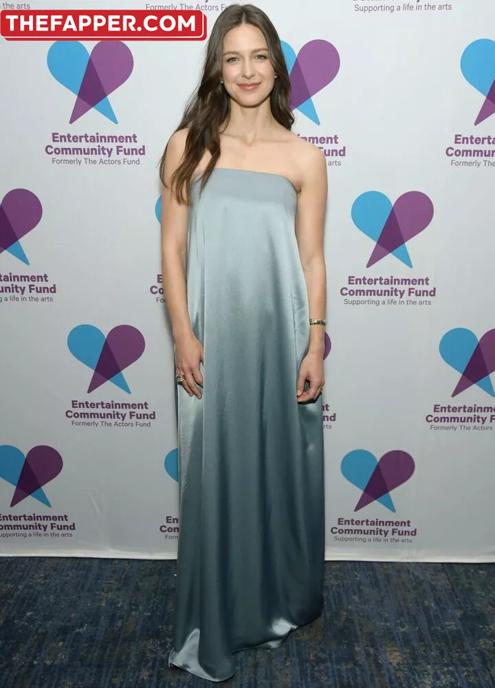 Melissa Benoist  Onlyfans Leaked Nude Image #yjPbzKcZTp
